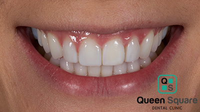 Dental Clinic Queen Square